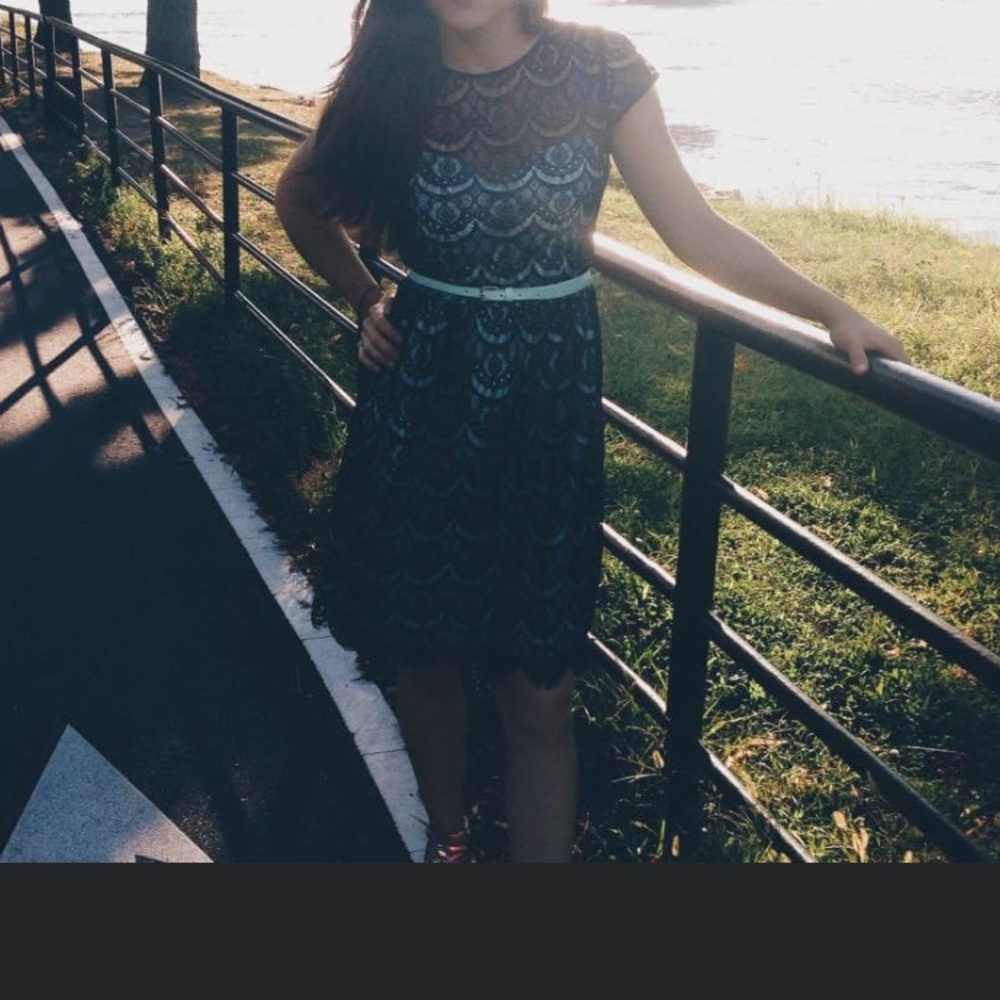 Black and baby blue lace dress